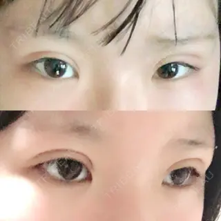 10日目の経過画像（1枚目）