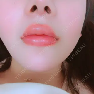 10日目の経過画像（2枚目）