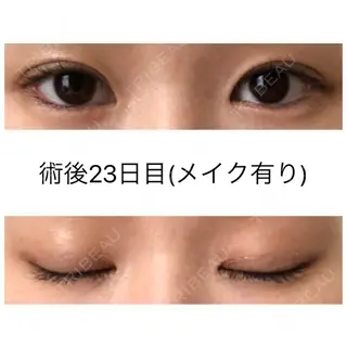 22日目の経過画像（2枚目）