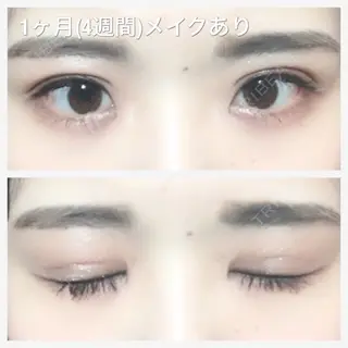 28日目の経過画像（1枚目）