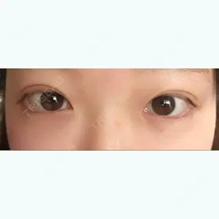 9日目の経過画像（1枚目）