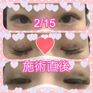 0日目の経過画像（1枚目）