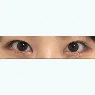 18日目の経過画像（1枚目）