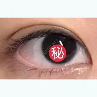 12日目の経過画像（1枚目）