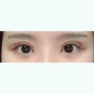 8日目の経過画像（1枚目）