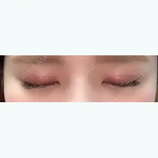 8日目の経過画像（3枚目）