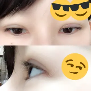 7日目の経過画像（2枚目）