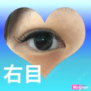 2日目の経過画像（2枚目）