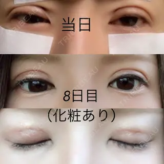 8日目の経過画像（2枚目）