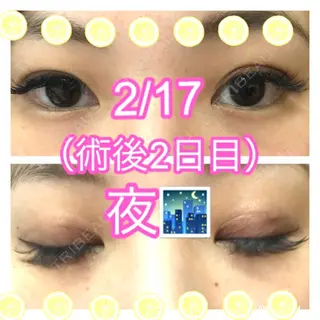 2日目の経過画像（1枚目）