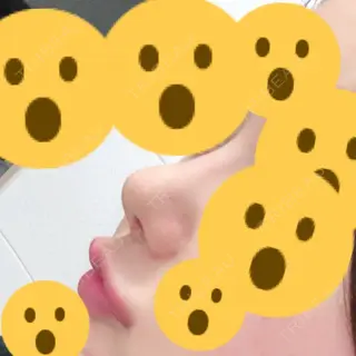 6日目の経過画像（1枚目）