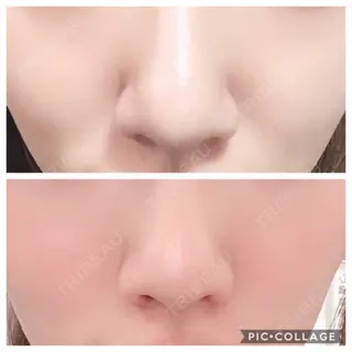 71日目の経過画像（3枚目）