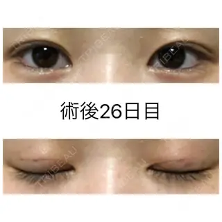 25日目の経過画像（1枚目）