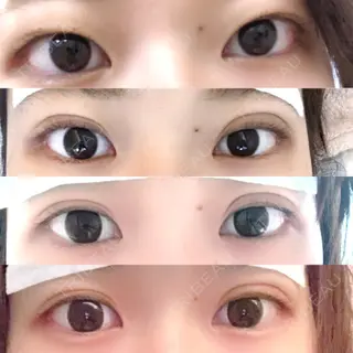 3日目の経過画像（1枚目）