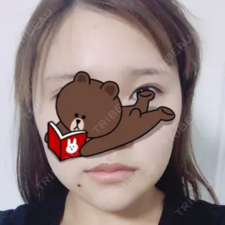 10日目の経過画像（1枚目）