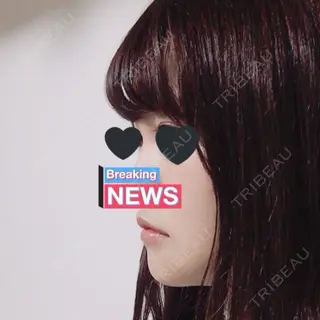 15日目の経過画像（2枚目）