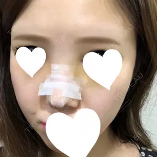 3日目の経過画像（1枚目）