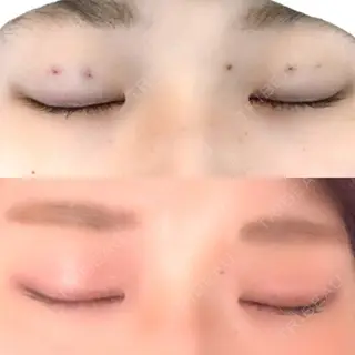 3日目の経過画像（1枚目）