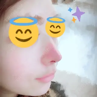 3日目の経過画像（1枚目）