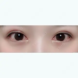 47日目の経過画像（1枚目）
