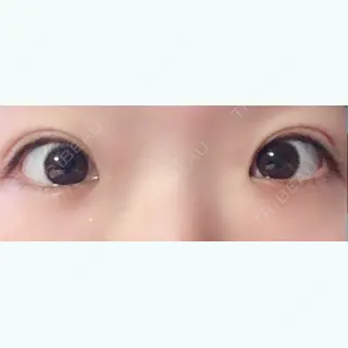80日目の経過画像（1枚目）