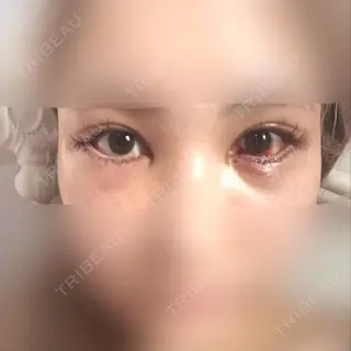 3日目の経過画像（1枚目）