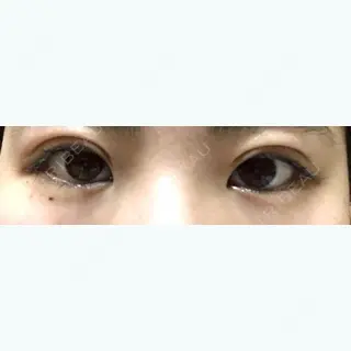 23日目の経過画像（1枚目）