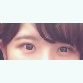 16日目の経過画像（3枚目）