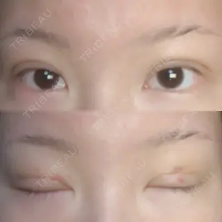 3日目の経過画像（1枚目）