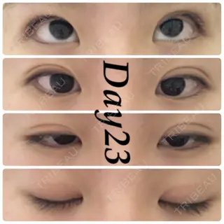 24日目の経過画像（1枚目）