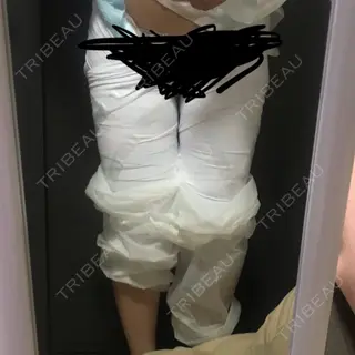 1日目の経過画像（1枚目）