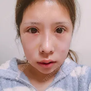16日目の経過画像（1枚目）