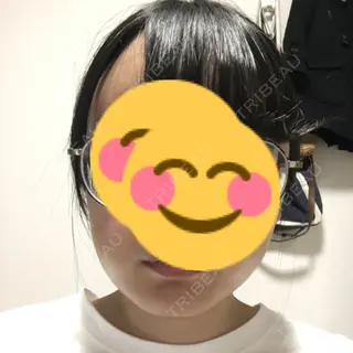 4日目の経過画像（1枚目）