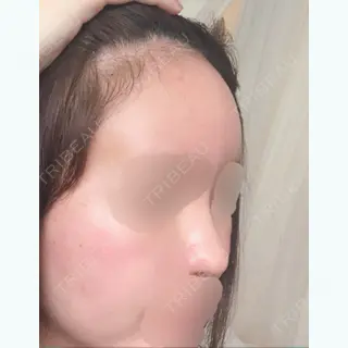 10日目の経過画像（1枚目）