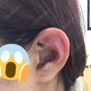 6日目の経過画像（1枚目）