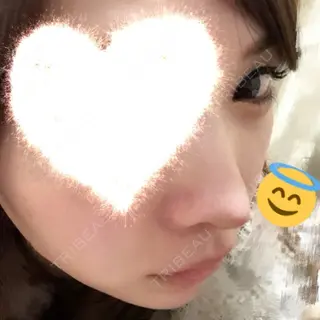 7日目の経過画像（1枚目）