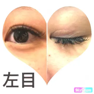 9日目の経過画像（2枚目）