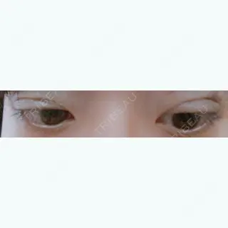4日目の経過画像（3枚目）