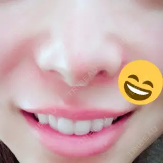 8日目の経過画像（2枚目）