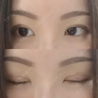 6日目の経過画像（1枚目）