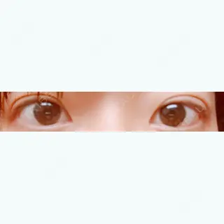 4日目の経過画像（1枚目）