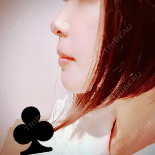 27日目の経過画像（2枚目）