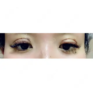 8日目の経過画像（2枚目）