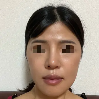 after image