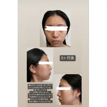 after image