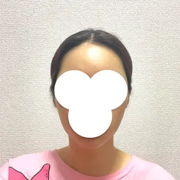 after image