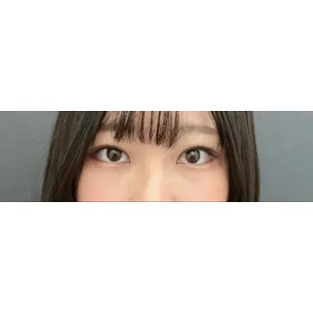 after image