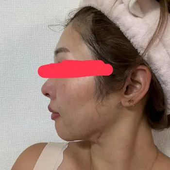 after image