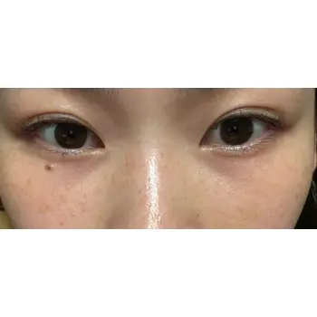 after image