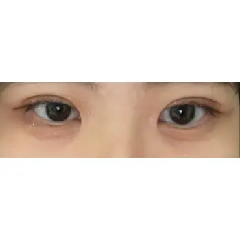 after image